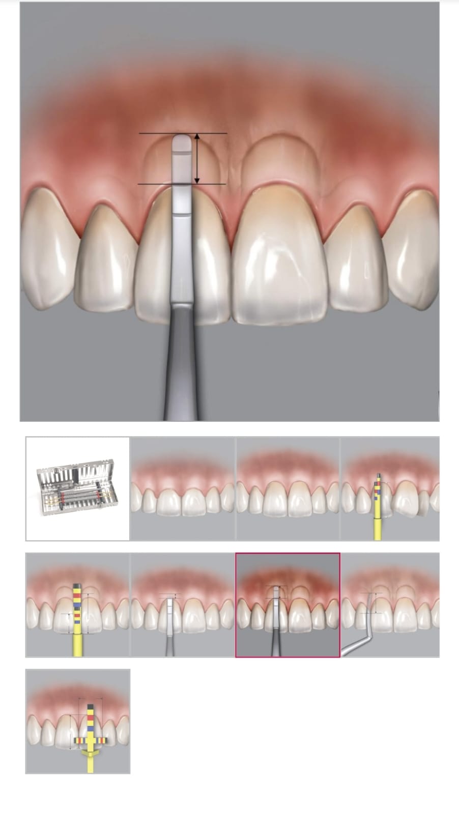 مجموعة أجهزة القياس التجميلية من CHU رقم 327